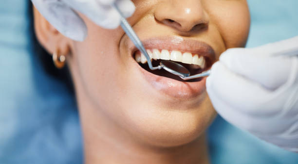 Best Tooth Infection Emergency Dentist  in Osceola, IA